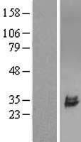 ULBP2 / RAET1H Protein - Western validation with an anti-DDK antibody * L: Control HEK293 lysate R: Over-expression lysate