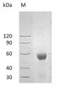 ULBP2 / RAET1H Protein - (Tris-Glycine gel) Discontinuous SDS-PAGE (reduced) with 5% enrichment gel and 15% separation gel.
