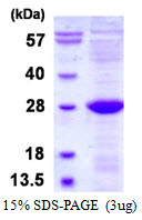 ULBP2 / RAET1H Protein