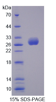 ULBP2 / RAET1H Protein - Recombinant UL16 Binding Brotein 2 By SDS-PAGE
