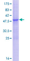 ULBP5 / RAET1G Protein - 12.5% SDS-PAGE of human RAET1G stained with Coomassie Blue