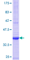 ULBP5 / RAET1G Protein - 12.5% SDS-PAGE Stained with Coomassie Blue.
