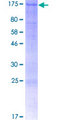 ULK1 Protein - 12.5% SDS-PAGE of human ULK1 stained with Coomassie Blue