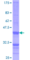 ULK1 Protein - 12.5% SDS-PAGE Stained with Coomassie Blue.