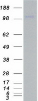 ULK1 Protein - Purified recombinant protein ULK1 was analyzed by SDS-PAGE gel and Coomassie Blue Staining