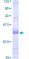 ULK2 Protein - 12.5% SDS-PAGE Stained with Coomassie Blue.