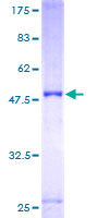 ULK3 Protein - 12.5% SDS-PAGE of human ULK3 stained with Coomassie Blue