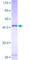 ULK3 Protein - 12.5% SDS-PAGE of human ULK3 stained with Coomassie Blue