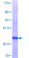 ULK3 Protein - 12.5% SDS-PAGE Stained with Coomassie Blue.