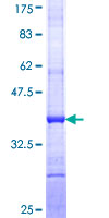 ULK4 Protein - 12.5% SDS-PAGE Stained with Coomassie Blue.