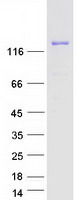 ULK4 Protein - Purified recombinant protein ULK4 was analyzed by SDS-PAGE gel and Coomassie Blue Staining