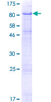 UMOD / Uromodulin Protein - 12.5% SDS-PAGE of human UMOD stained with Coomassie Blue