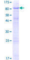 UMOD / Uromodulin Protein - 12.5% SDS-PAGE of human UMOD stained with Coomassie Blue