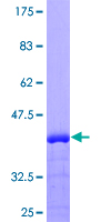 UMOD / Uromodulin Protein - 12.5% SDS-PAGE Stained with Coomassie Blue.