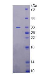 UMOD / Uromodulin Protein - Recombinant  Uromodulin By SDS-PAGE