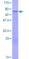 UMPS / OPRT Protein - 12.5% SDS-PAGE of human UMPS stained with Coomassie Blue