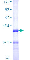 UMPS / OPRT Protein - 12.5% SDS-PAGE Stained with Coomassie Blue.