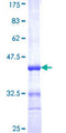 UMPS / OPRT Protein - 12.5% SDS-PAGE Stained with Coomassie Blue.