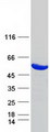UMPS / OPRT Protein - Purified recombinant protein UMPS was analyzed by SDS-PAGE gel and Coomassie Blue Staining