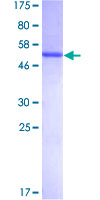 UNC119 / Retinal Protein 4 Protein - 12.5% SDS-PAGE of human UNC119 stained with Coomassie Blue