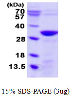 UNC119B Protein