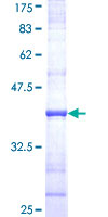 UNC13B Protein - 12.5% SDS-PAGE Stained with Coomassie Blue.