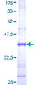 UNC13B Protein - 12.5% SDS-PAGE Stained with Coomassie Blue.