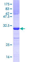 UNC13D Protein - 12.5% SDS-PAGE Stained with Coomassie Blue.