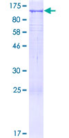 UNC45A Protein - 12.5% SDS-PAGE of human UNC45A stained with Coomassie Blue