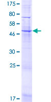 UNC50 Protein - 12.5% SDS-PAGE of human UNC50 stained with Coomassie Blue