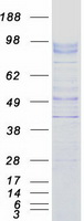 UNC5A Protein - Purified recombinant protein UNC5A was analyzed by SDS-PAGE gel and Coomassie Blue Staining