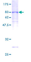 UNC5CL Protein - 12.5% SDS-PAGE of human UNC5CL stained with Coomassie Blue