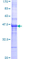 UNC5D Protein - 12.5% SDS-PAGE Stained with Coomassie Blue.