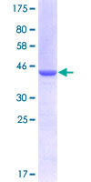 UNC5H2 / UNC5B Protein - 12.5% SDS-PAGE Stained with Coomassie Blue.