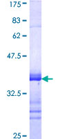 UNC5H3 / UNC5C Protein - 12.5% SDS-PAGE Stained with Coomassie Blue.