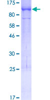 UNC84B / SUN2 Protein - 12.5% SDS-PAGE of human UNC84B stained with Coomassie Blue