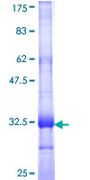 UNC93B / UNC93B1 Protein - 12.5% SDS-PAGE Stained with Coomassie Blue.
