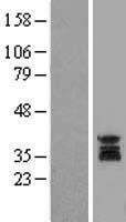 UNG / Uracil DNA Glycosylase Protein - Western validation with an anti-DDK antibody * L: Control HEK293 lysate R: Over-expression lysate