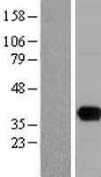 UNG / Uracil DNA Glycosylase Protein - Western validation with an anti-DDK antibody * L: Control HEK293 lysate R: Over-expression lysate