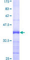 UNG / Uracil DNA Glycosylase Protein - 12.5% SDS-PAGE Stained with Coomassie Blue.