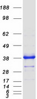 UNG / Uracil DNA Glycosylase Protein - Purified recombinant protein UNG was analyzed by SDS-PAGE gel and Coomassie Blue Staining