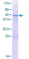 UNKL Protein - 12.5% SDS-PAGE of human UNKL stained with Coomassie Blue