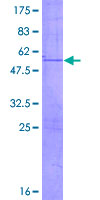 UNKL Protein - 12.5% SDS-PAGE of human UNKL stained with Coomassie Blue