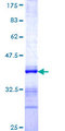 UNKL Protein - 12.5% SDS-PAGE Stained with Coomassie Blue.