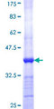 UP / UPP1 Protein - 12.5% SDS-PAGE Stained with Coomassie Blue.