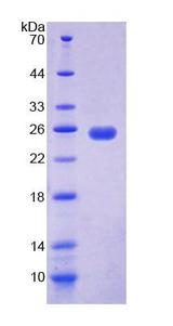 UP / UPP1 Protein - Recombinant Uridine Phosphorylase 1 By SDS-PAGE
