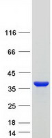 UP / UPP1 Protein - Purified recombinant protein UPP1 was analyzed by SDS-PAGE gel and Coomassie Blue Staining