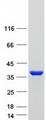UP / UPP1 Protein - Purified recombinant protein UPP1 was analyzed by SDS-PAGE gel and Coomassie Blue Staining