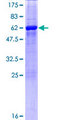 UP2 / UPP2 Protein - 12.5% SDS-PAGE of human UPP2 stained with Coomassie Blue