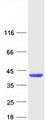 UP2 / UPP2 Protein - Purified recombinant protein UPP2 was analyzed by SDS-PAGE gel and Coomassie Blue Staining